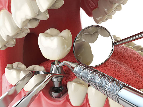Best Broken or Cracked Tooth Emergency Dentist in Centre, AL